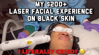 LASER ON BLACK SKIN CHANGED MY LIFE EXTRACTIONSDARK MARKS HYPERPIGMENTATIONACNE GOLDENCHILDCHI [upl. by Esille]