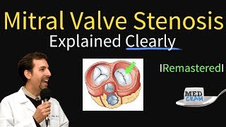 Understanding Mitral Regurgitation Signs and Symptoms [upl. by Llennhoj]