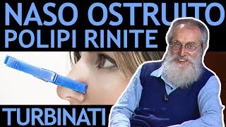 Dott Mozzi Naso ostruito polipi nasali turbinati rinite sinusite [upl. by Thursby]