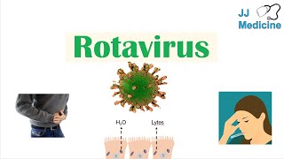 Rotavirus  Risk Factors Pathophysiology Symptoms Diagnosis Treatment [upl. by Direj]