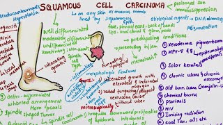 Squamous Cell Carcinoma  Pathology [upl. by Nednil]