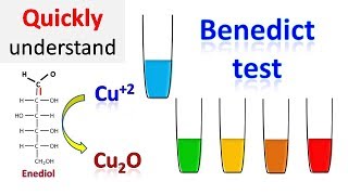 Benedicts test [upl. by Vernier374]