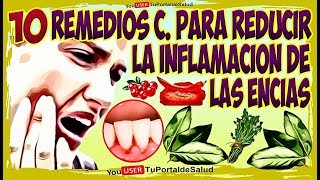 10 Remedios Caseros Para Reducir Inflamacion de las Encias  Como Tratar las Encias Inflamadas [upl. by Akcirederf]