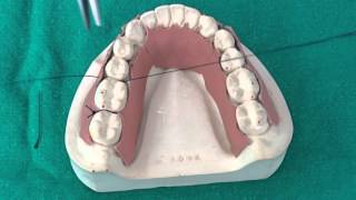 Peridontal Suturing Techniques [upl. by Knarf]