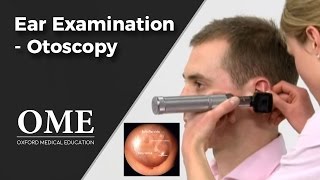 Otoscopy Ear Examination  ENT [upl. by Creigh]