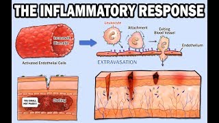 THE INFLAMMATORY RESPONSE [upl. by Ynos]