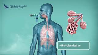 Percussionaire High Frequency Ventilation [upl. by Davilman]