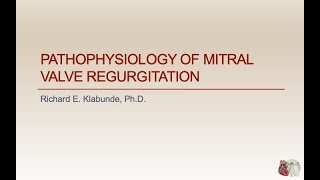 MitraClip Procedure For Mitral Regurgitation Patients [upl. by Llerrac553]