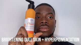 HOW I GOT RID OF DARK SPOTS BRIGHTEN DULL SKIN  HYPERPIGMENTATION [upl. by Drugi726]