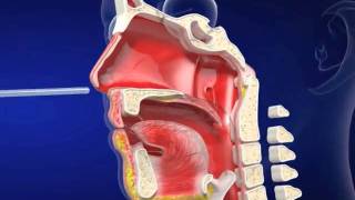 Nasogastric eLearning from Vygon UK Ltd [upl. by Amej712]