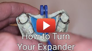 How to Turn Your Expander [upl. by Notle]