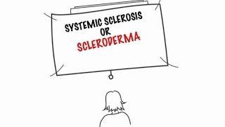 Understanding Systemic Sclerosis [upl. by Enaitsirk]