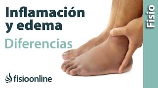 Inflamación y edema  Diferencias y características [upl. by Aikyn]