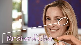 Botox Augenfalten Krähenfüße – Video Dr Günther – Experte für Botox Hyaluron und Laser [upl. by Marelya]