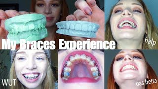 3 YEARS OF BRACES IN UNDER 30 MINS  VLOGstyle experience  transformation quotglowupquot [upl. by Marozik]