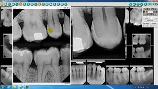 DEXIS™ Imaging Suite Toolbar Overview  Part Two [upl. by Haek58]