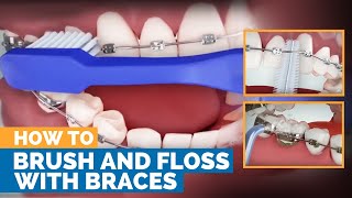 How to Brush amp Floss with Braces [upl. by Relyks647]