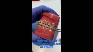 How to Cut an Orthodontic Wire at Home  David Ross Orthodontics [upl. by Herring239]