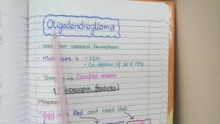 CNS Tumors  Robbins Pathology [upl. by Munafo1]