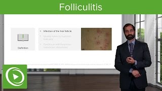 Infectious Skin Diseases Folliculitis – Pathology  Lecturio [upl. by Stiruc]